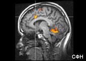 Сканирование мозга помогает справиться с болью [15.12.2005 08:47]