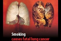 Как бросить курить: шокирующие картинки на сигаретах [31.05.2006 04:24]