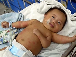 В Китае был рожден трехрукий младенец, врачи не знают, какую конечность резать [31.05.2006 09:09]